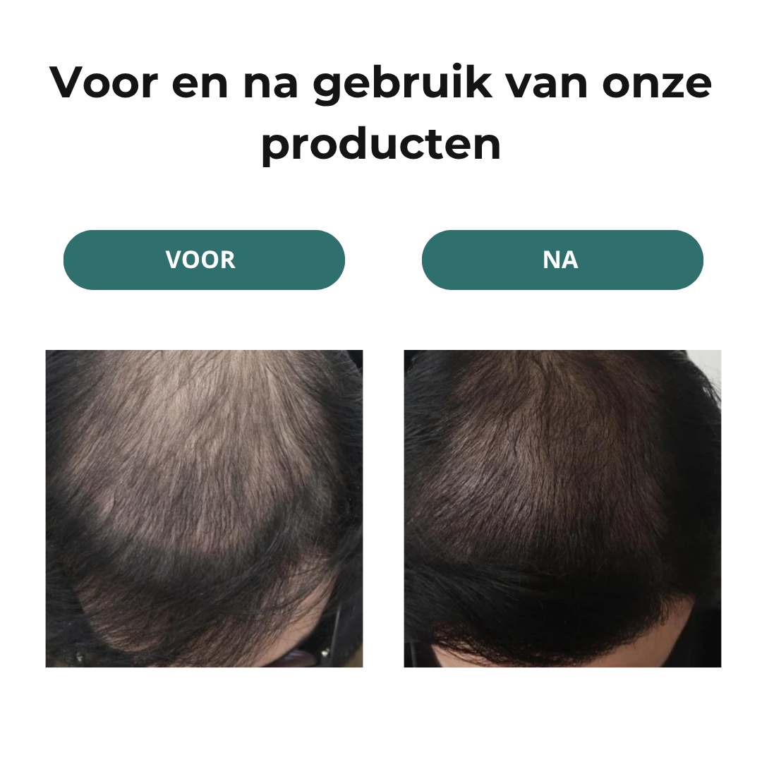 HairRevive™ LED Lichttherapie Haargroeikap